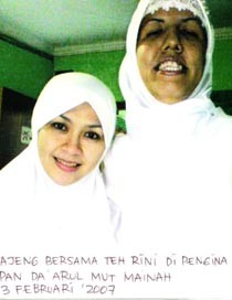 Marfans Syndrom Terjadi pada 1: 100 Ribu Kelahiran 